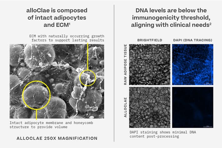 alloClae composition: intact adipocytes, ECM, and DNA levels below immunogenicity threshold