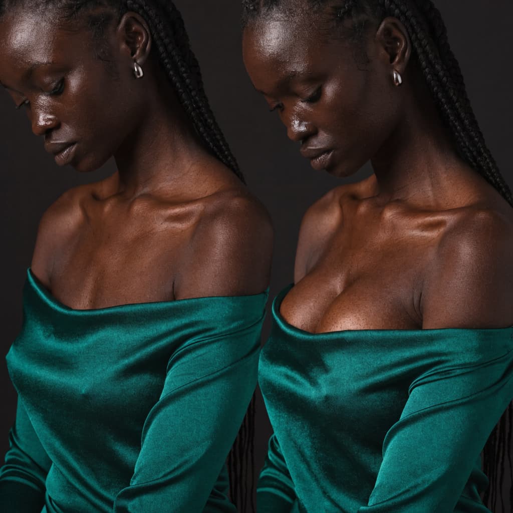 Breast Augmentation before and after