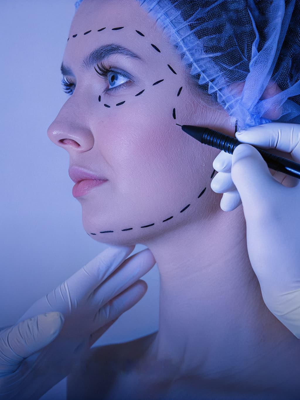 Facial Surgery