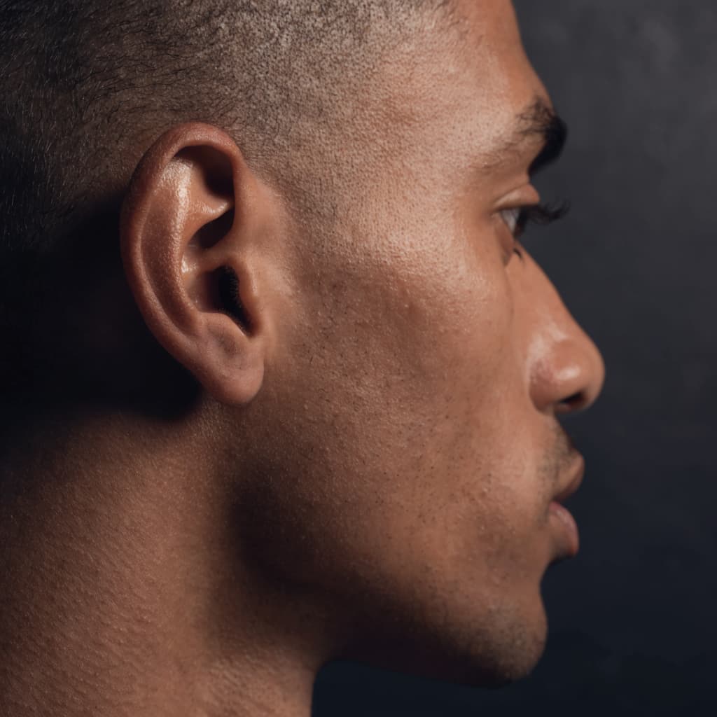 Close-up of an ear representing otoplasty for men