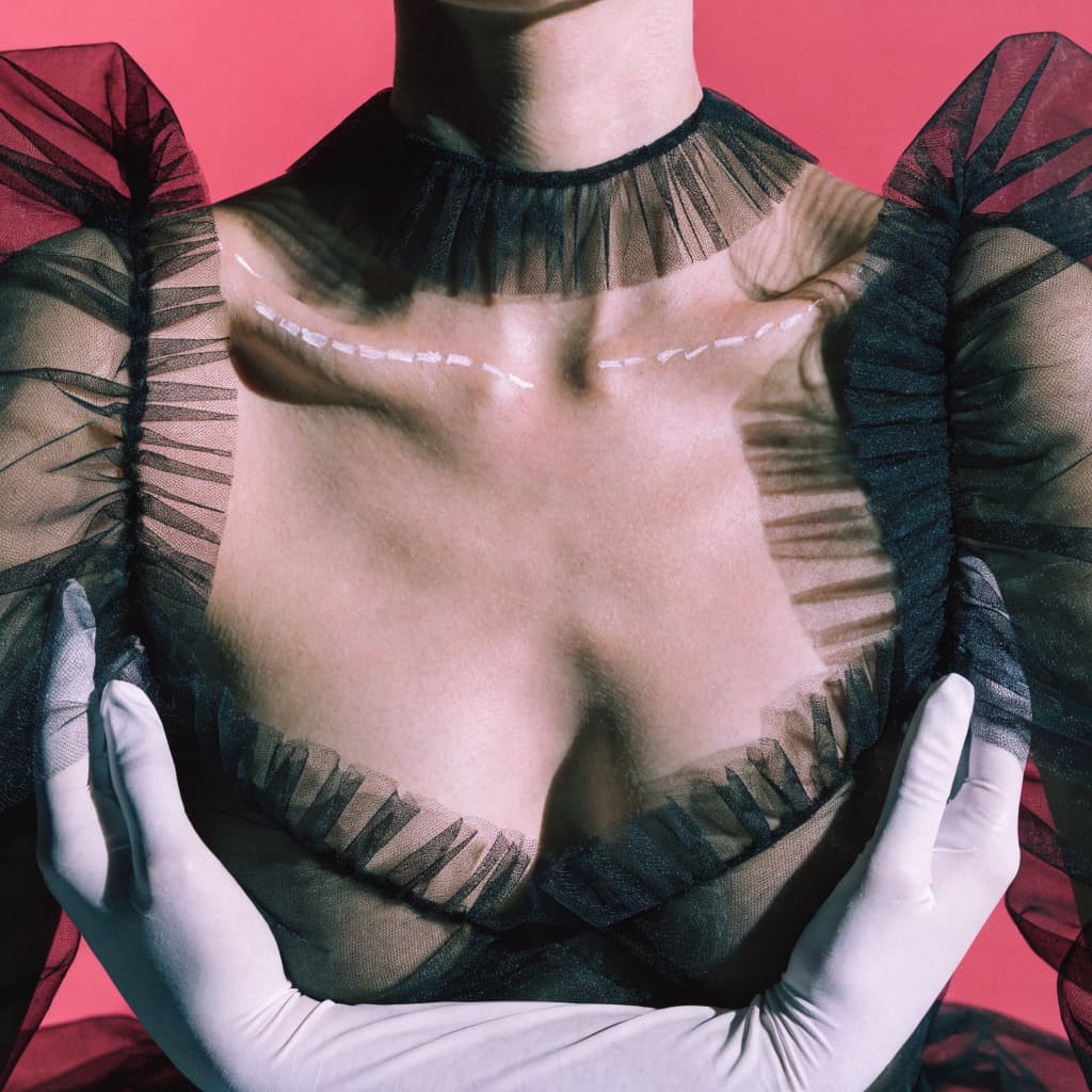 Breast Augmentation