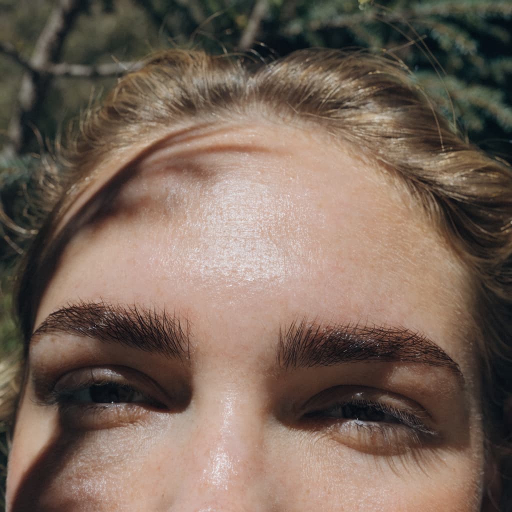 Brow Lift