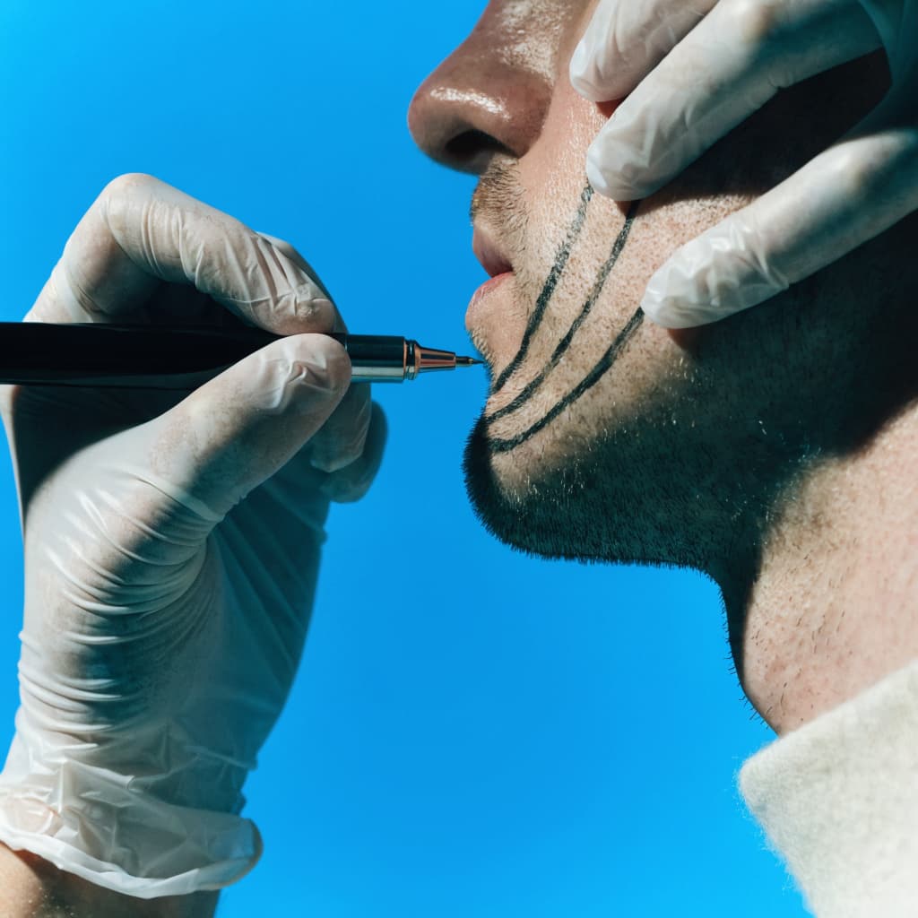 Chin Implants