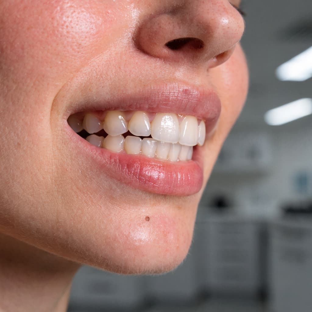 Orthognathic Surgery