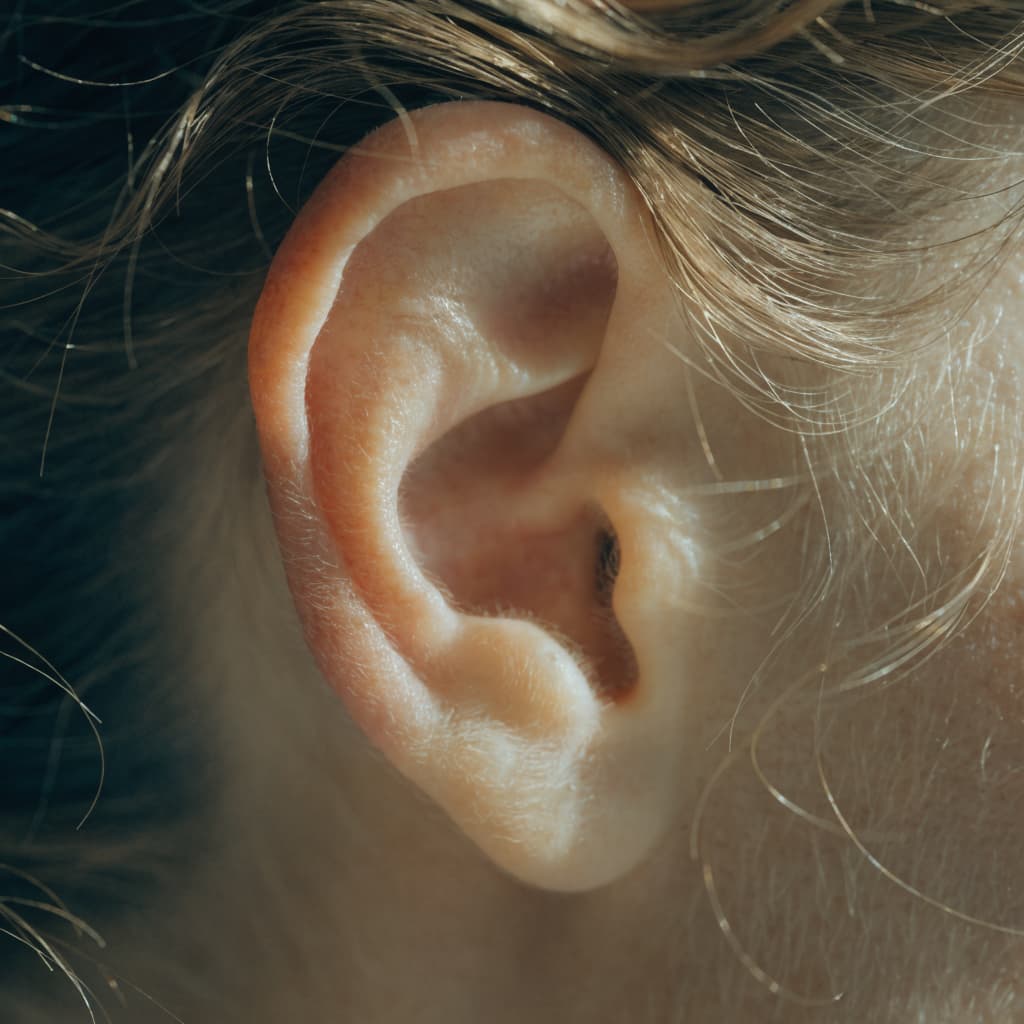 Otoplasty (Ear Surgery)