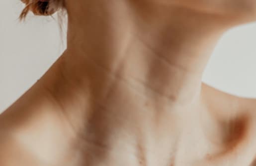 Renuva Neck treatment